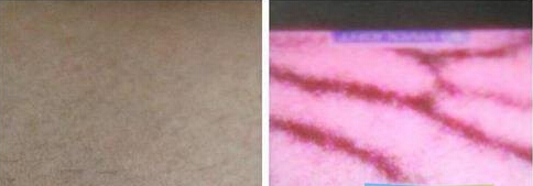 醫(yī)療線路板廠